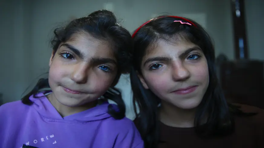 Farklı göz renkleri olan kız kardeşler görenleri şaşırtıyor