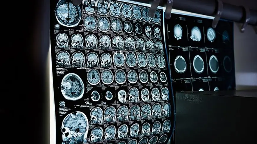 Türkiye'de geçen yıl 2 milyon 700 bin kolorektal kanser taraması yapıldı