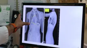 Uzmanından omurga sağlığı uyarısı