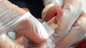 Kan gruplarının kanser üzerindeki etkisi araştırıldı